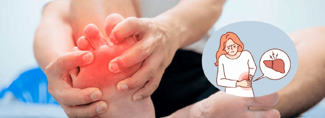 Cardiologista alerta: 7 sinais nos pés que podem indicar que o fígado não vai bem