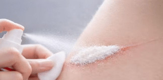 Cientistas criam spray que estanca hemorragias em menos de 1 segundo
