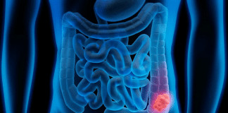 A dieta silenciosa que especialistas dizem ser “pior que fumar” — e pode estar destruindo seu intestino