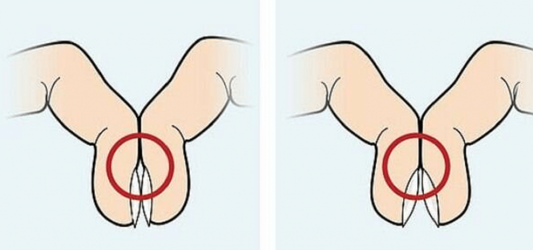 “Encoste as unhas por 10 segundos: teste simples pode revelar sinal precoce de câncer de pulmão.”