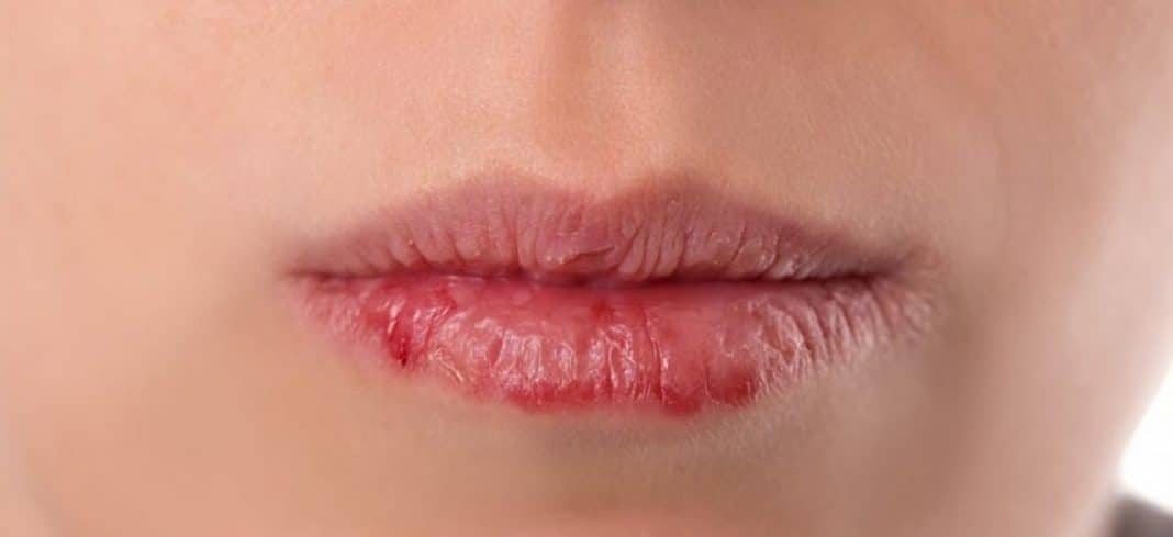 Boca seca o tempo todo? Isso pode ser um alerta do seu corpo — Saiba quando investigar