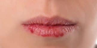 Boca seca o tempo todo? Isso pode ser um alerta do seu corpo — Saiba quando investigar